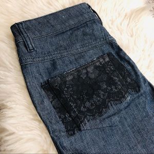 Black Gold Label Diesel Shorts wt Pocket Lace Trim